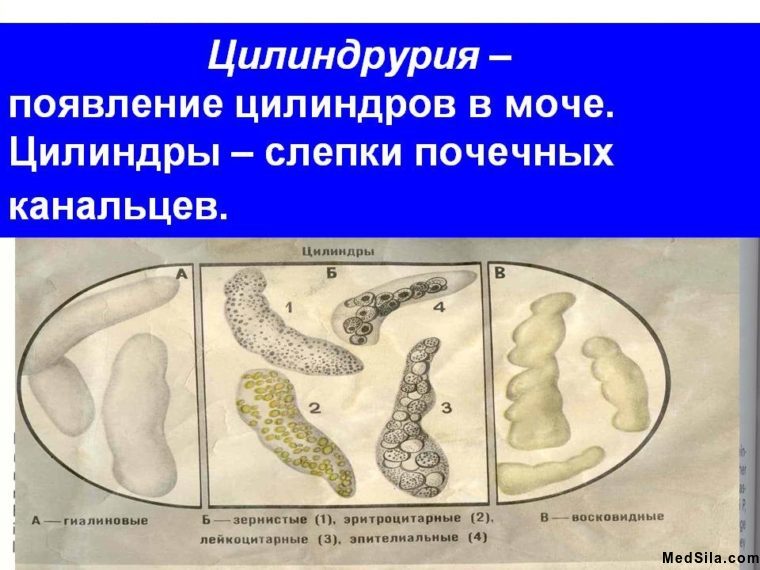 Виды цилиндров